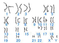 これは男性の染色体図(核型)です。1番から22番までは男女共通の「常染色体」、最後の1対は性別を決める「性染色体」です。染色体には縞模様が見えますが、これは染色液の染まり方の違いです。21番染色体は全染色体の中で最もサイズが小さく、含まれる遺伝子の数も比較的少ないという特徴があります。